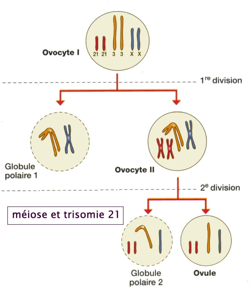 trisomie 21_meiose.jpg